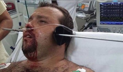 spearfishing-pic-1068x623.jpg (94.89KiB)Przejrzano 108310 razy spearfishing-pic-1068x623.jpg