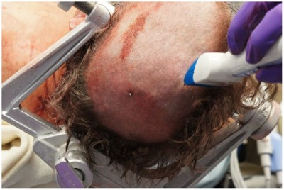 speargun-suicide-03.jpg (80.8KiB)Przejrzano 108351 razy speargun-suicide-03.jpg