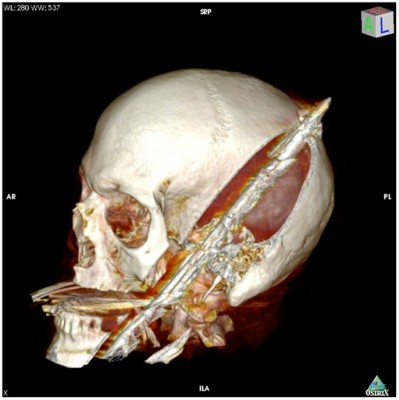 speargun-suicide-01.jpg (72.65KiB)Przejrzano 108307 razy speargun-suicide-01.jpg