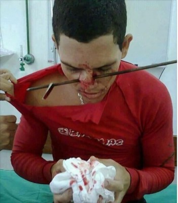 Nose shot.jpg (169.39KiB)Przejrzano 108308 razy Nose shot.jpg