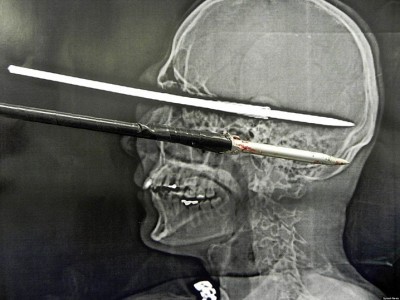 speargun-accidents_zpsad7b6ea1.jpg (94.17KiB)Przejrzano 80897 razy speargun-accidents_zpsad7b6ea1.jpg