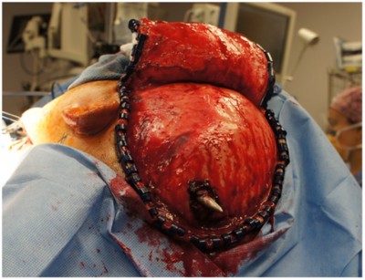 speargun-suicide-04.jpg (90.22KiB)Przejrzano 95801 razy speargun-suicide-04.jpg