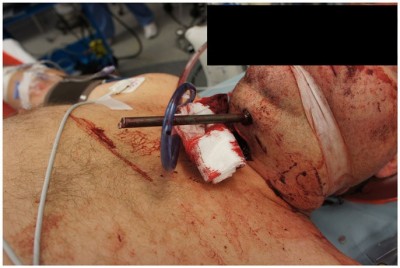 speargun-suicide-02.jpg (73.25KiB)Przejrzano 95447 razy speargun-suicide-02.jpg