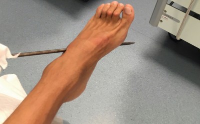 Freediving accident Federico Mana.jpg (190.11KiB)Przejrzano 121413 razy Freediving accident Federico Mana.jpg